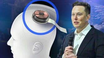Elon Musk brain implants