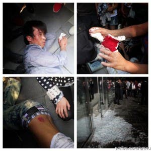 battered people at beijing apple store